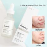 serum-niacinamide-ordinary